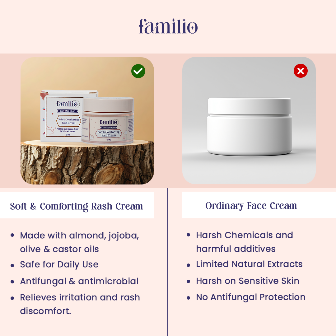 Soft and Comforting Rash Cream