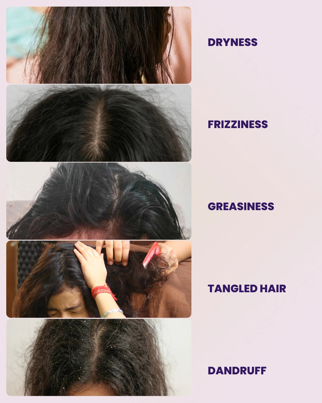 India's Gentlest Shampoo For Your Kids' Frizz Free Hair